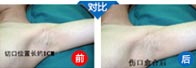 成功案例图片